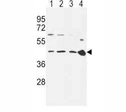 CCR7 Antibody - image 1