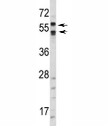 CA9 Antibody (Carbonic Anhydrase IX) - image 1