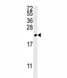 TREM2 Antibody - image 1