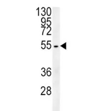 Tubulin beta 3 Antibody (TUBB3) - image 1
