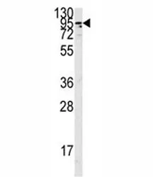 Angiotensin-Converting Enzyme 2 Antibody (ACE2) - image 1