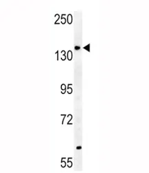 ABCB4 Antibody - image 1