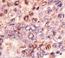ABCB7 Antibody - image 1
