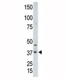 CDX2 Antibody - image 1