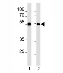 MEF2C Antibody - image 1