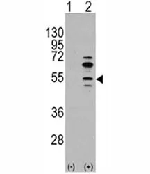 MEF2C Antibody - image 1