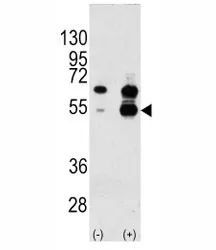 VEGFA Antibody - image 1