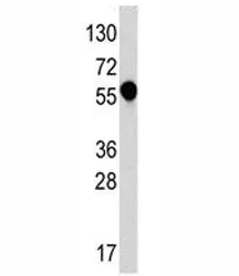 IL1R1 Antibody - image 1