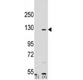PARP Antibody - image 1