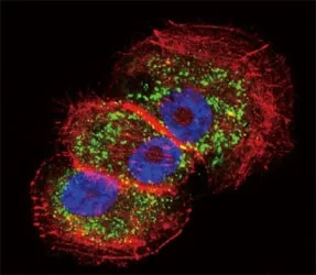 Parkin Antibody - image 1