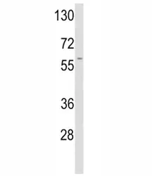 tPA Antibody / Tissue Plasminogen Activator - image 1