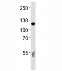 Complement C6 Antibody - image 1