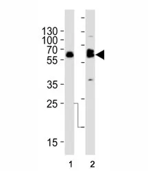Tyrosine Hydroxylase Antibody (TH) - image 1