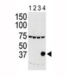 Aurora-C Antibody (AURKC) - image 1
