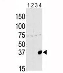 Aurora-C Antibody (AURKC) - image 1