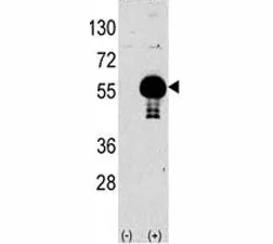 AKT2 Antibody - image 1