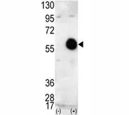 AKT2 Antibody - image 1