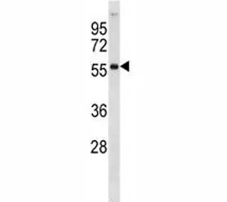 AKT2 Antibody - image 1