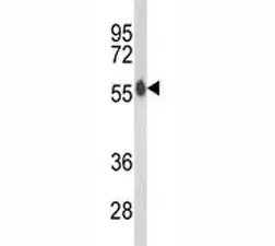 AKT2 Antibody - image 1