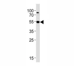 AKT3 Antibody - image 1