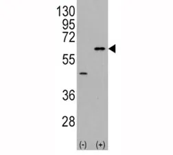 AKT3 Antibody - image 1