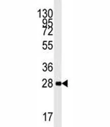 AMPK beta 1 Antibody (PRKAB1) - image 1