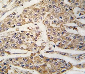 Pyruvate Kinase Antibody / PKM2 - image 1