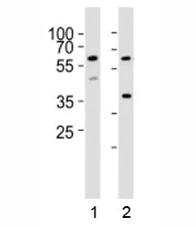 RIPK3 Antibody - image 1