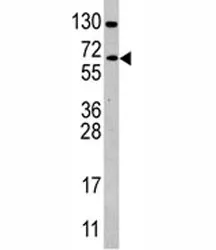 CDC25B Antibody - image 1