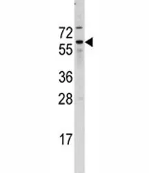 CDC25B Antibody - image 1