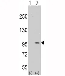 DDR1 Antibody - image 1