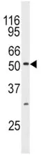 JNK3 Antibody - image 1