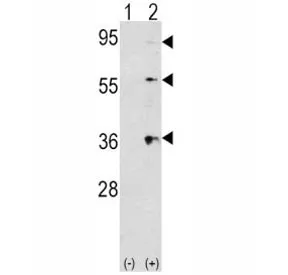 Thrombopoietin Antibody (THPO) - image 1
