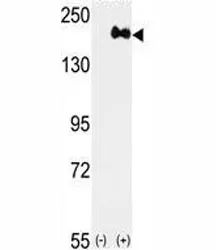 HER2 Antibody - image 1