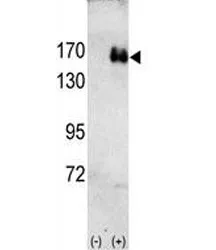 HER2 Antibody - image 1