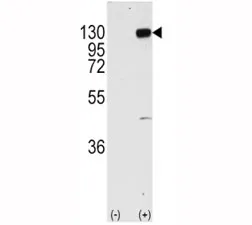 FGFR1 Antibody - image 1