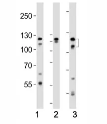 Fibroblast growth factor receptor 2 Antibody (FGFR2) - image 1
