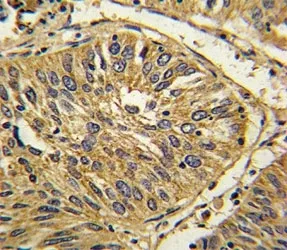 Fibroblast growth factor receptor 2 Antibody (FGFR2) - image 1