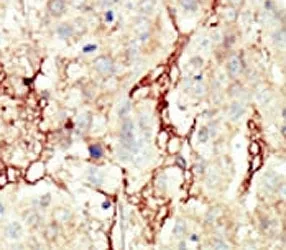 Fibroblast Growth Factor Receptor 3 Antibody (FGFR3) - image 1
