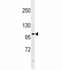 FGFR4 Antibody - image 1