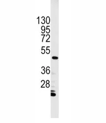 Integrin linked kinase Antibody - image 1