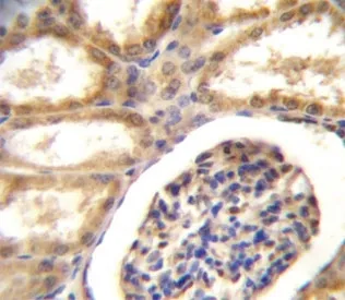 DDR1 Antibody - image 1