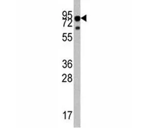 TrkA Antibody (NTRK1) - image 1