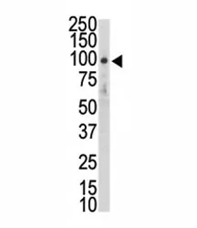 DDR2 Antibody - image 1
