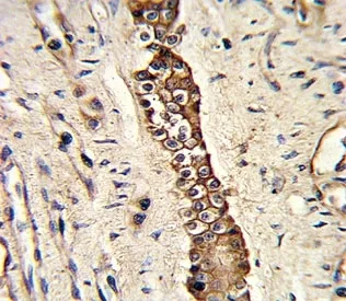 DDR2 Antibody (TYRO10) - image 1