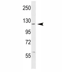 c-Abl Antibody (ABL1) - image 1