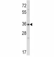 Connective Tissue Growth Factor Antibody - image 1