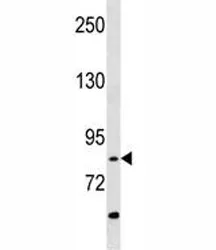 RIPK4 Antibody (ANKRD3) - image 1