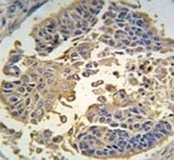 RIPK3 Antibody - image 1