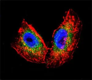Acetylcholinesterase Antibody / ACHE - image 1